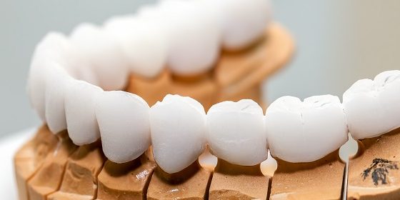 精细陶瓷薄膜结合力试验